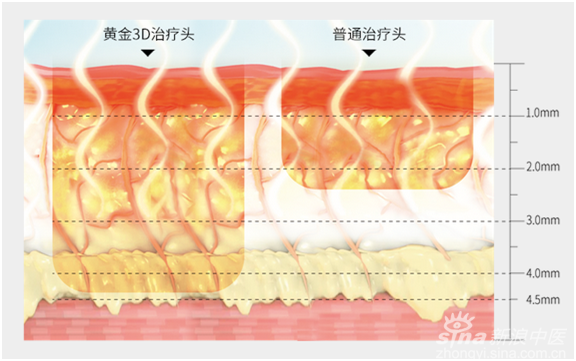 东方整形医院,贺洁院长,热玛吉