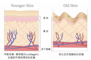 双11医美囤货，抗衰热门项目热玛吉or黄金热拉提2.0怎么选？